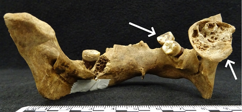 photo of jaw bone from
