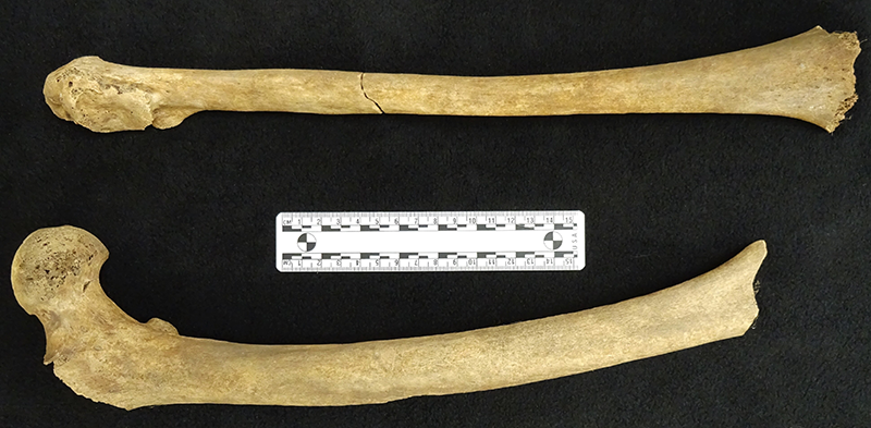 photo of two human thigh bones